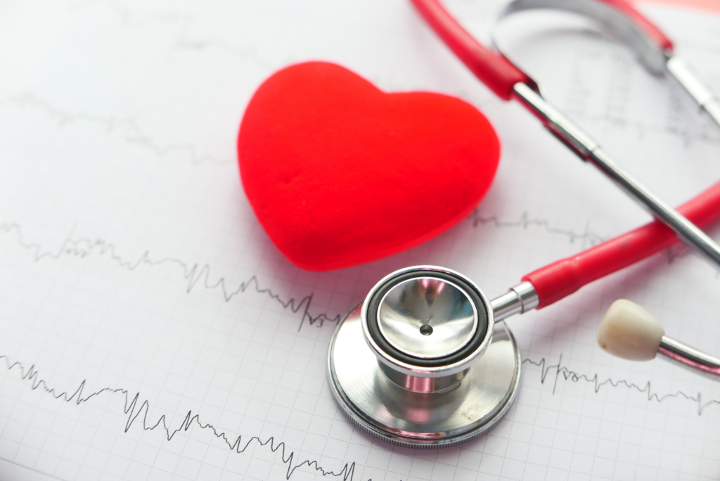 image of stethoscope and a heart on ekg 
