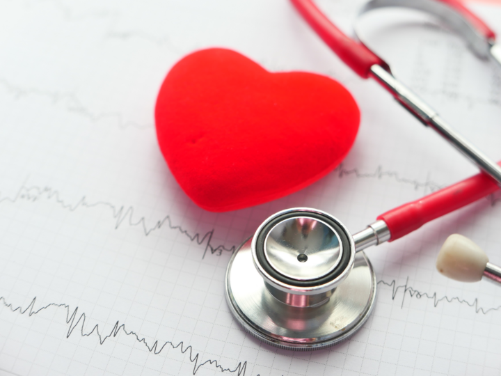 image of stethoscope and a heart on ekg